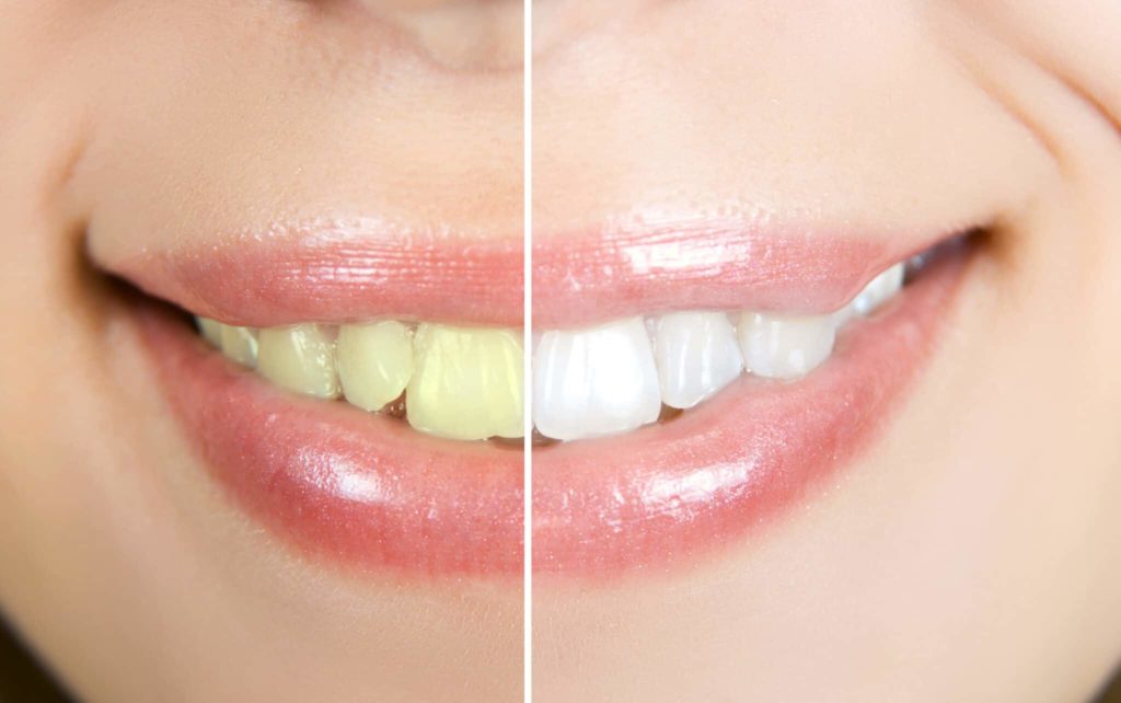 Comment blanchir les dents avec des huiles essentielles Nature.tn