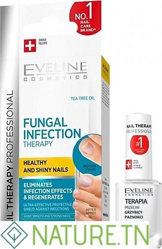 EVELINE COSMETICS FUNGAL INFECTION THERAPY 12ML 1 EVELINE COSMETICS FUNGAL INFECTION THERAPY 12ML 1