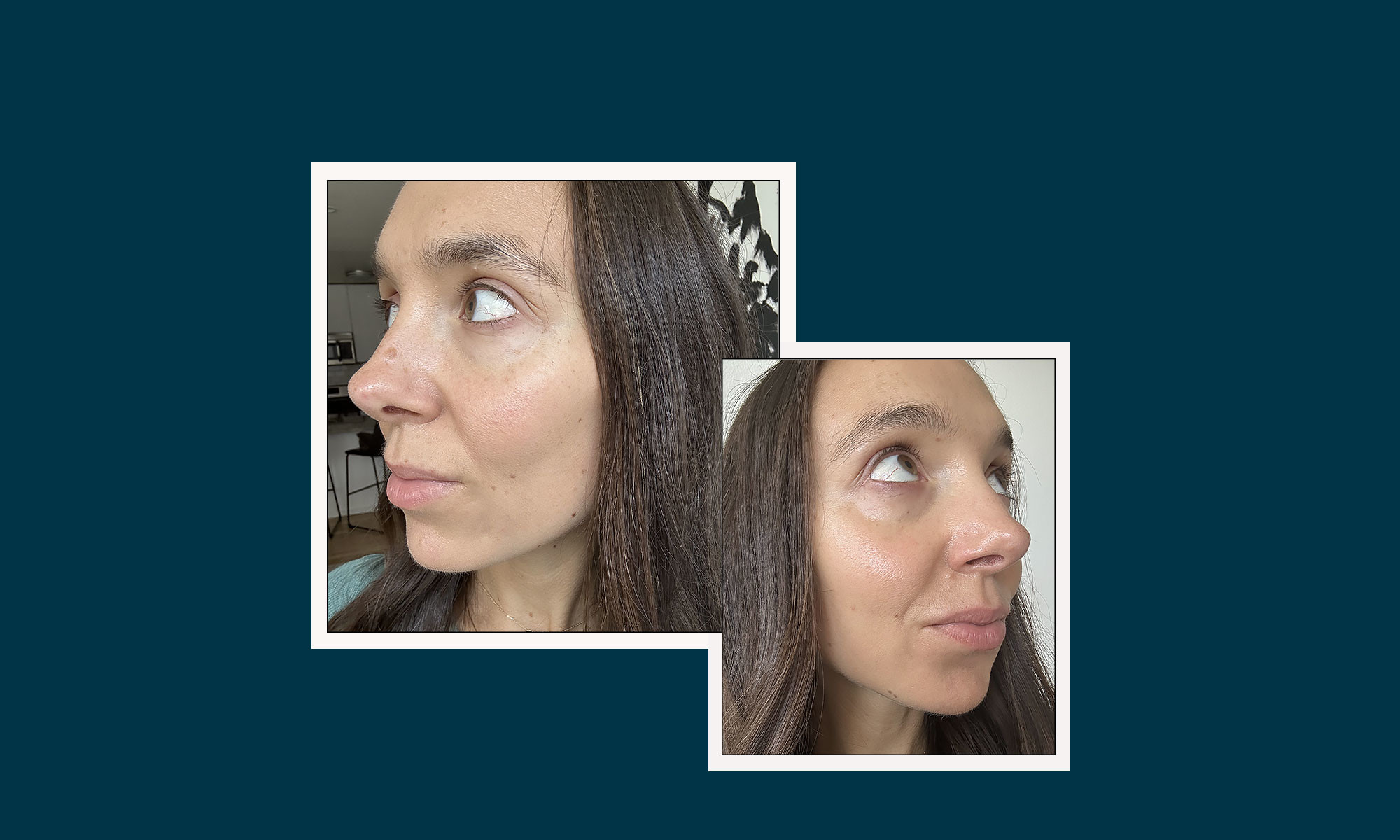 Les femmes de tous âges disent que ce traitement donne à leur peau une apparence ferme, rebondie et jeune
